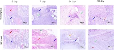 Construction and properties of the silk fibroin and polypropylene composite biological mesh for abdominal incisional hernia repair